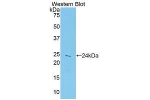 Western blot analysis of the recombinant protein. (Peroxiredoxin 5 抗体  (AA 1-210))