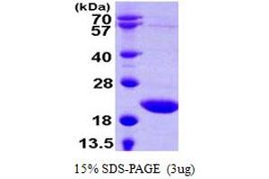 tRNA Splicing Endonuclease 15 Homolog (TSEN15) (AA 1-171) protein (His tag)