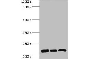 Western blot All lanes: RPL9 antibody at 0. (RPL9 抗体  (AA 1-192))