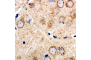 Immunohistochemical analysis of GAS3 staining in human brain formalin fixed paraffin embedded tissue section. (PMP22 抗体  (C-Term))