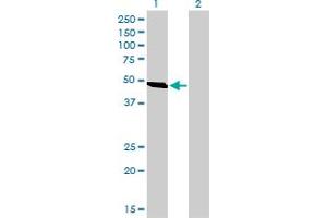 Western Blot analysis of C9orf98 expression in transfected 293T cell line by C9orf98 monoclonal antibody (M01), clone 3B8. (AK8 抗体  (AA 381-479))