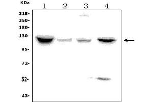 Western blot analysis of NPR1 using anti-NPR1 antibody (ABIN7602080).