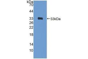Detection of Recombinant GATA4, Rat using Polyclonal Antibody to GATA Binding Protein 4 (GATA4) (GATA4 抗体  (AA 228-440))