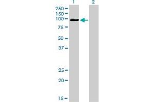 Western Blot analysis of MCC expression in transfected 293T cell line by MCC monoclonal antibody (M01), clone 1A7. (MCC 抗体  (AA 31-130))