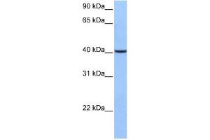AGBL5 antibody used at 1 ug/ml to detect target protein. (AGBL5 抗体  (C-Term))