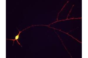 Immunofluorescence of cultured rat hippocampal neurons showing staining of tau in red along the neuronal processes. (MAPT 抗体)