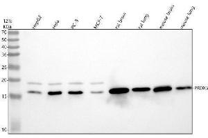 Western blot analysis of Peroxiredoxin 5 using anti-Peroxiredoxin 5 antibody (ABIN7605917).