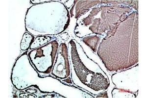 Immunohistochemical analysis of paraffin-embedded Human Thyroid Tissue using TTR Mouse mAb diluted at 1:200. (TTR 抗体)