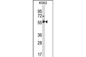 Western blot analysis in K562 cell line lysates (35ug/lane). (CBLC 抗体  (C-Term))