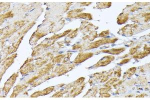 Immunohistochemistry of paraffin-embedded Mouse heart using SLC25A5 Polyclonal Antibody at dilution of 1:100 (40x lens). (SLC25A5 抗体)