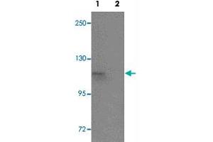 Western blot analysis of SCUBE1 in Daudi cell lysate with SCUBE1 polyclonal antibody  at 1 ug/mL in (1) the absence and (2) the presence of blocking peptide. (SCUBE1 抗体  (Internal Region))