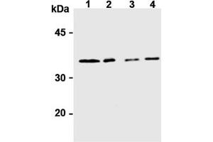 Western Blotting (WB) image for anti-Syntaxin 6 (STX6) antibody (ABIN492572) (Syntaxin 6 抗体)