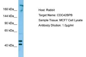 Western Blotting (WB) image for anti-CDC42 Binding Protein Kinase beta (DMPK-Like) (CDC42BPB) (C-Term) antibody (ABIN2790145) (CDC42BPB 抗体  (C-Term))