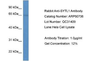 WB Suggested Anti-SYTL1  Antibody Titration: 0.