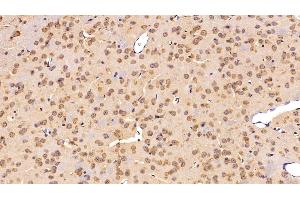 Detection of C3 Convertase in Mouse Cerebrum Tissue using Polyclonal Antibody to Complement C3 Convertase (C3 Convertase) (Complement C3 Convertase 抗体)
