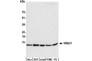 anti-Vacuolar H+-ATPase Homolog (VMA21) (AA 1-50) antibody