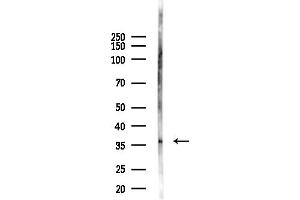 Western blot analysis of lysates from F10-LUC cells(heat-shock,45 min treatment), using NKX3.