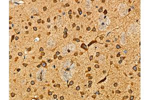 ABIN6265513 and ABIN6276479 at 1/100 staining Mouse brain tissue by IHC-P. (TDGF1 抗体  (Internal Region))