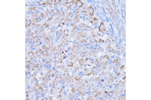 Immunohistochemistry of paraffin-embedded rat ovary using MT-ND1 antibody (ABIN7268598) at dilution of 1:100 (40x lens).