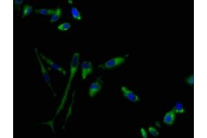 Immunofluorescence staining of Hela cells with ABIN7153315 at 1:100, counter-stained with DAPI. (G Protein-Coupled Receptor 1 抗体  (AA 308-355))