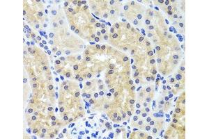 Immunohistochemistry of paraffin-embedded Mouse kidney using INADL Polyclonal Antibody at dilution of 1:100 (40x lens). (PATJ 抗体)