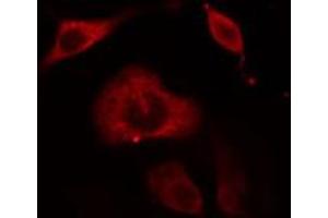 ABIN6274657 staining Hela cells by IF/ICC. (Cytochrome P450 3A4, 3A5 抗体)
