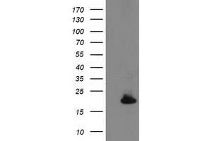 HEK293T cells were transfected with the pCMV6-ENTRY control (Left lane) or pCMV6-ENTRY DSTN (Right lane) cDNA for 48 hrs and lysed. (Destrin 抗体)