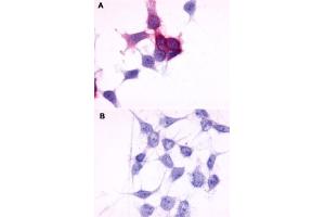 Immunocytochemistry (ICC) staining of HEK293 human embryonic kidney cells transfected (A) or untransfected (B) with P2RY6. (P2RY6 抗体  (C-Term))
