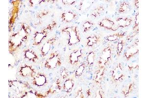 Immunohistochemistry of paraffin-embedded mouse kidney using Clathrin heavy chain Rabbit mAb (ABIN7266404) at dilution of 1:100 (40x lens). (Clathrin Heavy Chain (CLTC) 抗体)