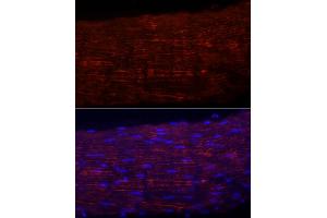 Immunofluorescence analysis of Rat colon using CTSC antibody (ABIN7267936) at dilution of 1:100 (40x lens). (ITGA5 抗体)