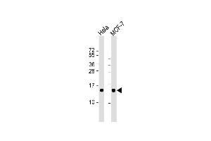 Lane 1: HeLa, Lane 2: MCF-7 cell lysate at 20 µg per lane, probed with bsm-51373M ISG15 (1031CT2. (ISG15 抗体)