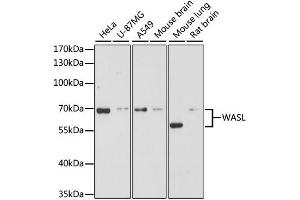 Western blot analysis of extracts of various cell lines, using WASL antibody. (Neural Wiskott-Aldrich syndrome protein (WASL) 抗体)