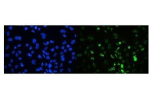 IF analysis of TIF1 gamma using anti-TIF1 gamma antibody (ABIN3043492). (TRIM33 抗体  (AA 1001-1127))