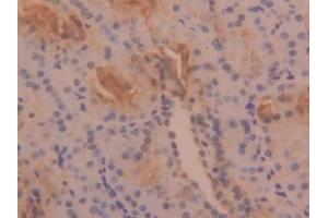 Detection of TPS in Human Kidney Tissue using Polyclonal Antibody to Tryptase (TPS) (TPSAB1 抗体  (AA 161-262))