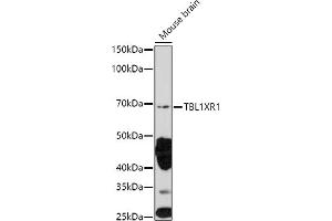 Western blot analysis of extracts of Mouse brain, using TBL1XR1 antibody (ABIN6132717, ABIN6148893, ABIN6148895 and ABIN6217436) at 1:1000 dilution. (TBL1XR1 抗体  (AA 1-180))
