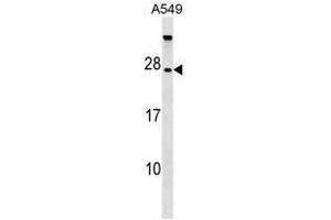 TBC1D28 Antibody (Center) western blot analysis in A549 cell line lysates (35µg/lane). (TBC1D28 抗体  (Middle Region))