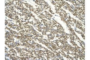 Immunohistochemistry (IHC) image for anti-TAF7 RNA Polymerase II, TATA Box Binding Protein (TBP)-Associated Factor, 55kDa (TAF7) (N-Term) antibody (ABIN2774669)