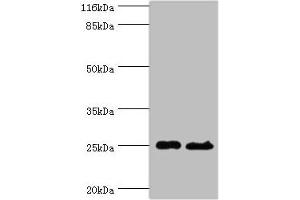 Western blot All lanes: Calcineurin B homologous protein 3 antibody at 2 μg/mL Lane 1: Hela whole cell lysate Lane 2: Mouse brain tissue Secondary Goat polyclonal to rabbit at 1/10000 dilution Predicted band size: 25, 19, 22 kDa Observed band size: 25 kDa (Tescalcin 抗体  (AA 2-214))