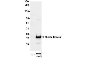 Western Blotting (WB) image for anti-Troponin I (TNNI) antibody (ABIN7795609)