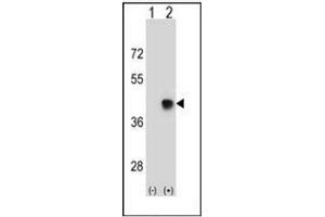 Western blot analysis of SPEM1 (arrow) using SPEM1 Antibody (Center) Cat. (SPEM1 抗体  (Middle Region))