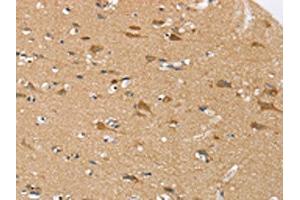 The image on the left is immunohistochemistry of paraffin-embedded Human brain tissue using ABIN7192337(SEZ6L Antibody) at dilution 1/30, on the right is treated with synthetic peptide. (SEZ6L 抗体)