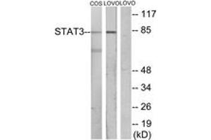 Western blot analysis of extracts from LOVO/COS7 cells, using STAT3 Antibody. (STAT3 抗体  (AA 656-705))