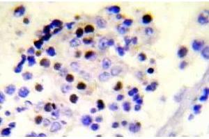 Immunohistochemistry (IHC) analyzes of p-Histone H2A. (H2AFX 抗体  (pSer139))