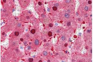 Human Liver: Formalin-Fixed, Paraffin-Embedded (FFPE) (FAH 抗体  (N-Term))