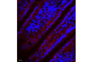 Immunofluorescence of paraffin embedded mouse small intestine using SLC7A8 (ABIN7074503) at dilution of 1:300 (400x lens) (LAT2 抗体)