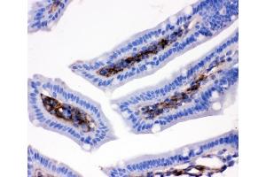 IHC analysis of CD9 using anti-CD9 antibody (ABIN4886531). (CD9 抗体  (AA 110-193))