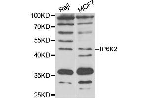 Western blot analysis of extracts of Raji and MCF7 cell lines, using IP6K2 antibody. (IP6K2 抗体)