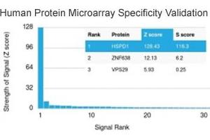 Analysis of HuProt(TM) microarray containing more than 19,000 full-length human proteins using recombinant HSP60 antibody (clone rGROEL/780).
