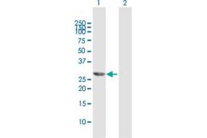 Western Blotting (WB) image for anti-Homeobox B9 (HOXB9) (AA 1-250) antibody (ABIN516638)