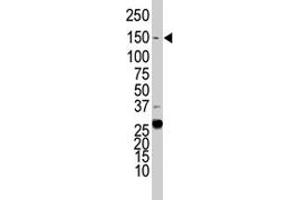Western blot analysis of KDR polyclonal antibody  in HeLa cell lysate. (VEGFR2/CD309 抗体  (C-Term))